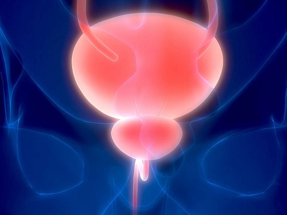 An Overactive Bladder Yakima Urology Associates PLLC
