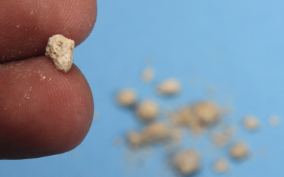 Learn About Kidney Stones